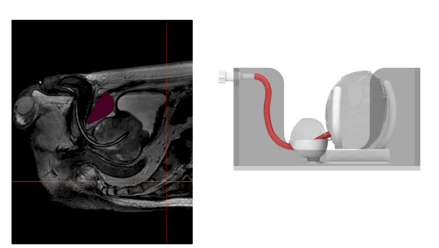 CT-derived anatomical data behind the US-P001 model
