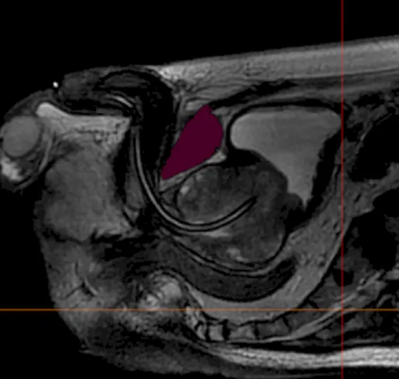 Cross-section view of the US-P001 urological training model